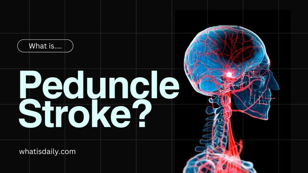 What is Penduncle Stroke